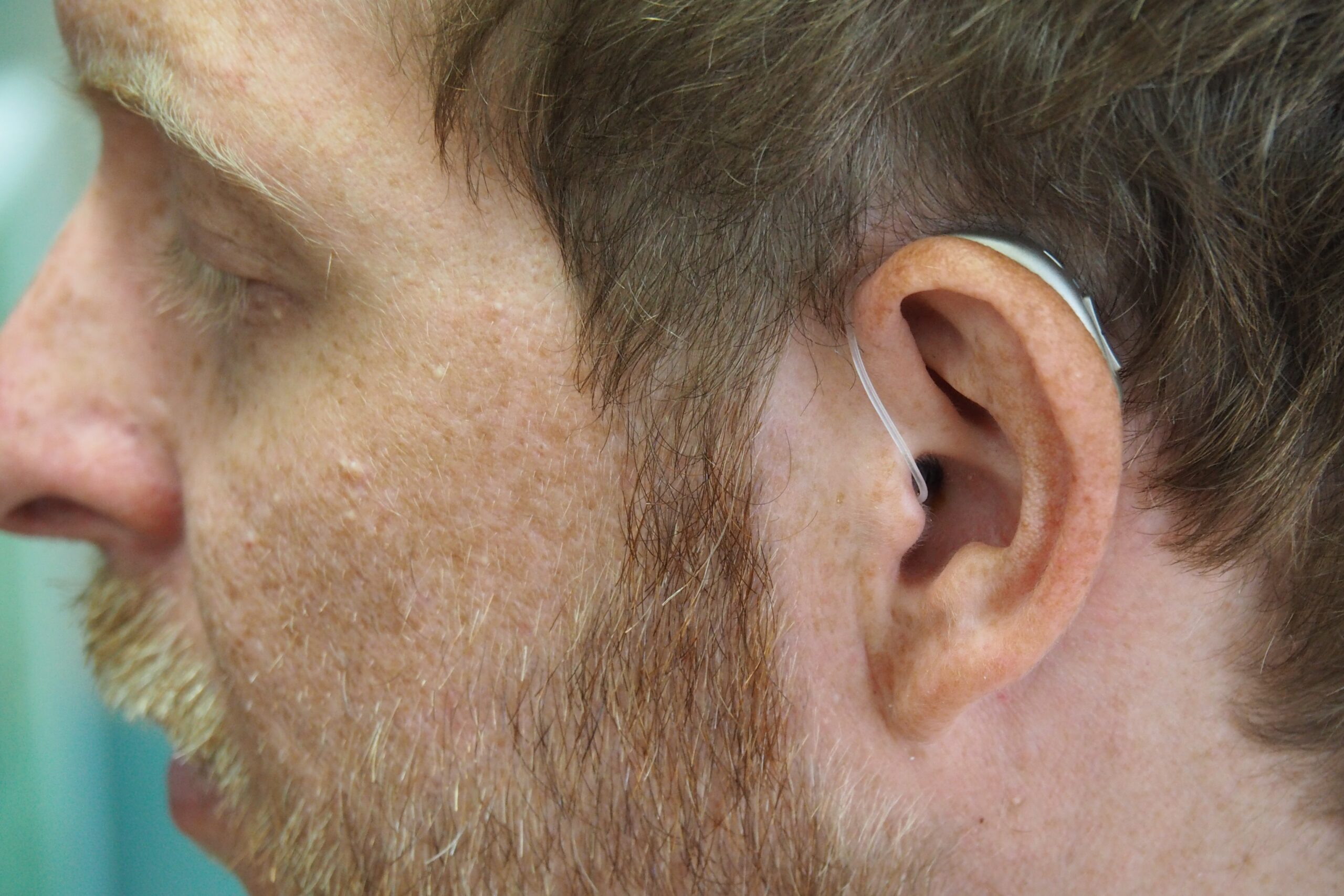 RIC slušni aparat postavljen na uhu muškarca
