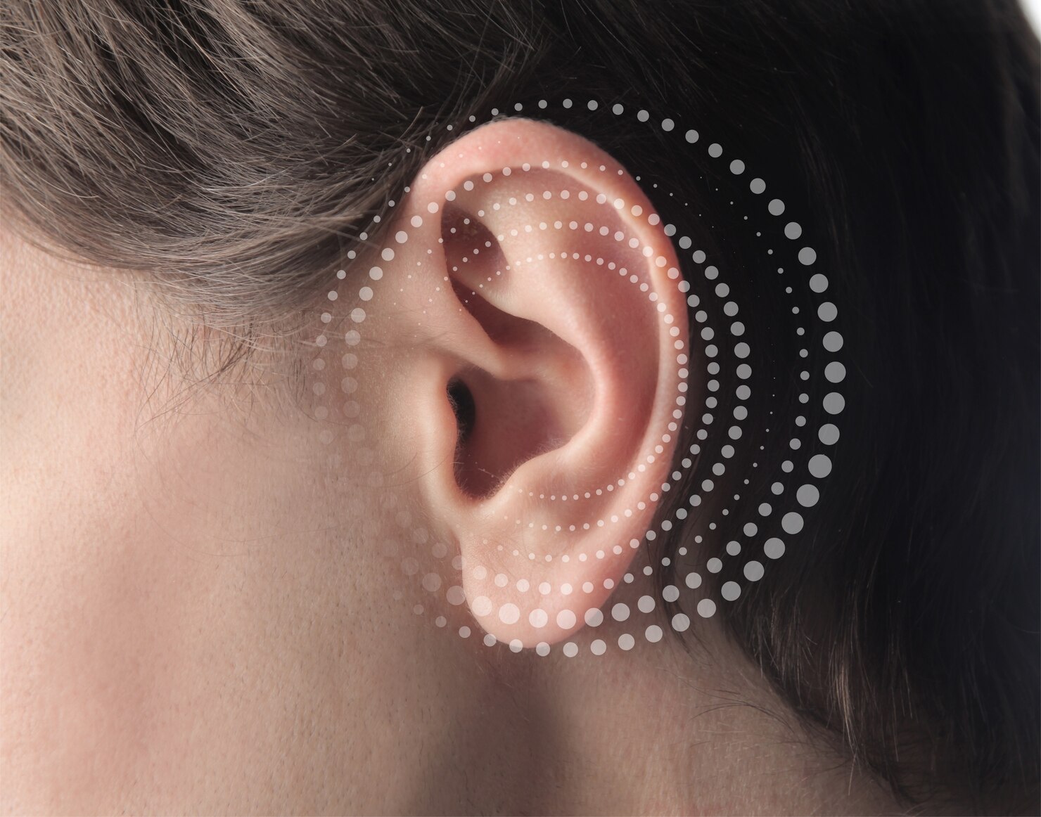 Uvo sa nacrtanim kružićima sačinjenim od takčica koje predstavljaju zujanje u ušima